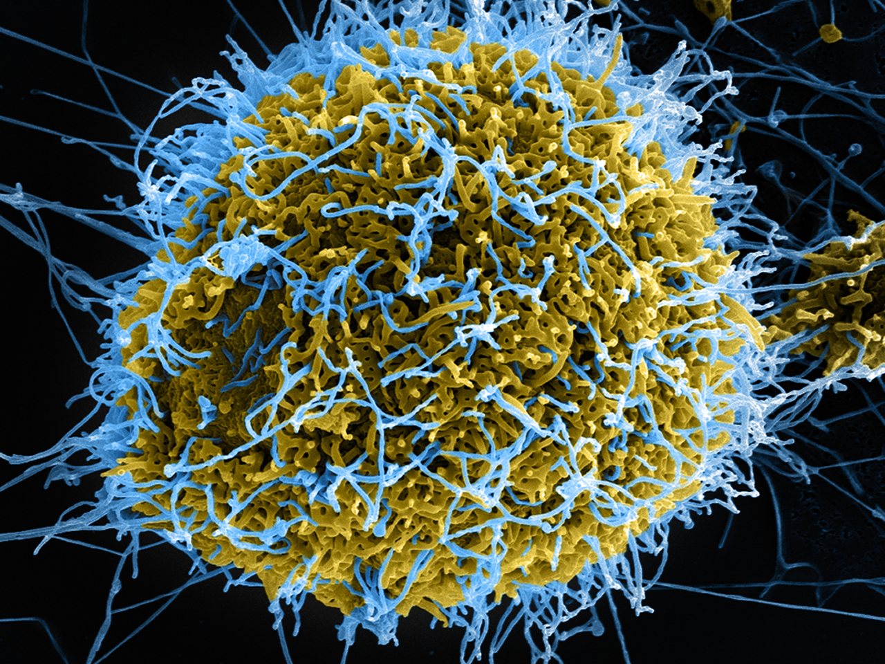 An illustration of the Ebola virus (file photo)